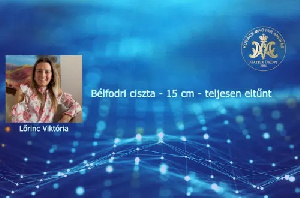 Bélfodri ciszta – 15 cm – teljesen eltűnt – Lőrinc Viktória